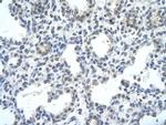 RASSF7 Polyclonal Antibody