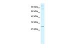 RNF3 Polyclonal Antibody
