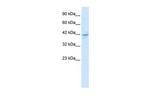 ZNF237 Polyclonal Antibody
