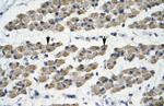TRIM68 Polyclonal Antibody