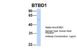 BTBD1 Polyclonal Antibody