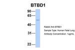 BTBD1 Antibody in Western Blot (WB)