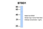 BTBD1 Antibody in Western Blot (WB)