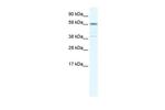 TRIM41 Antibody in Western Blot (WB)