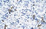 TRIM17 Antibody in Immunohistochemistry (IHC)