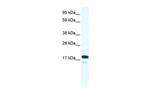 TAF9 Antibody in Western Blot (WB)