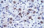 RNF141 Antibody in Immunohistochemistry (IHC)