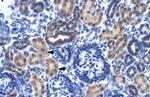 RNF141 Polyclonal Antibody