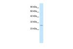 RNF141 Antibody in Western Blot (WB)