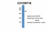 SETD4 Antibody in Western Blot (WB)