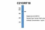 SETD4 Antibody in Western Blot (WB)