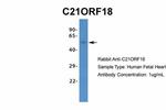SETD4 Antibody in Western Blot (WB)