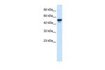 SETD4 Antibody in Western Blot (WB)