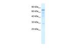 TRMT1 Polyclonal Antibody