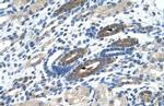NACC2 Polyclonal Antibody