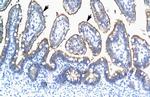 TRIM15 Polyclonal Antibody