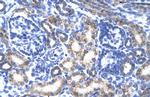 CREB3L2 Polyclonal Antibody