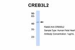 CREB3L2 Antibody in Western Blot (WB)