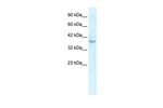 KLHL14 Polyclonal Antibody