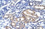 MEIS2 Polyclonal Antibody