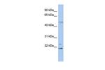 RBBP9 Antibody in Western Blot (WB)