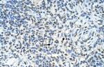 ZMYND11 Antibody in Immunohistochemistry (IHC)