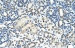 ZMYND11 Antibody in Immunohistochemistry (Paraffin) (IHC (P))