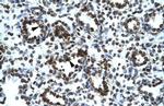 PRR7 Polyclonal Antibody
