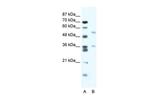BTBD3 Polyclonal Antibody