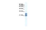 TRIM34 Polyclonal Antibody