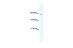 KLHL5 Polyclonal Antibody