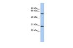 TRIM38 Polyclonal Antibody