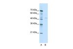 TRIM38 Polyclonal Antibody