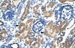 HSF2BP Polyclonal Antibody