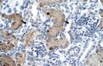 ZNF258 Polyclonal Antibody