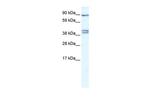 CLCNKB Polyclonal Antibody