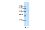 CACNB3 Polyclonal Antibody