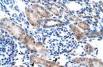 CLIC1 Polyclonal Antibody