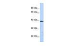 KCNK1 Polyclonal Antibody