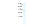 KCNK3 Polyclonal Antibody