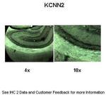KCNN2 Polyclonal Antibody