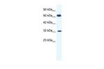 KCNN1 Polyclonal Antibody