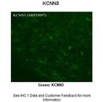 KCNN3 Polyclonal Antibody