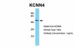 KCNN4 Antibody in Western Blot (WB)