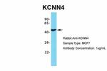 KCNN4 Antibody in Western Blot (WB)