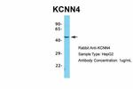 KCNN4 Antibody in Western Blot (WB)