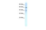 KV4.3 (KCND3) Polyclonal Antibody