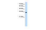 TRPM5 Antibody in Western Blot (WB)