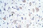 KCNIP1 Polyclonal Antibody
