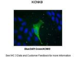 KCNK9 Polyclonal Antibody